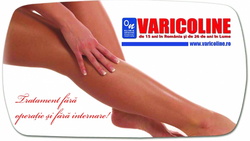 ON CLINIC FOTO VARICE