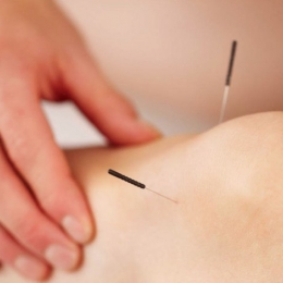 Gonartroza se poate trata şi cu ajutorul acupuncturii