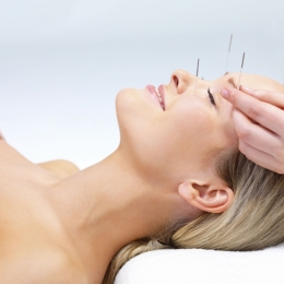 Acupunctura - remediul pentru a scăpa de durere