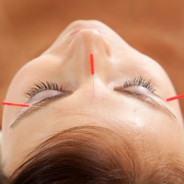 Spuneţi "nu" răcelilor! Imunitatea creşte prin acupunctură