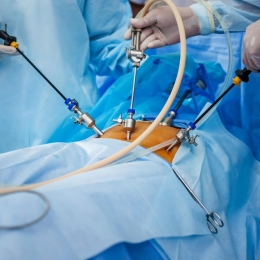 Care sunt avantajele intervenţiilor realizate laparoscopic