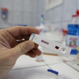 Programări gratuite pentru HIV şi hepatită